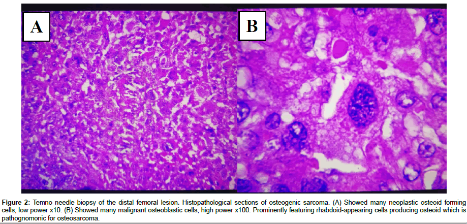 experimental-oncology-pathognomonic
