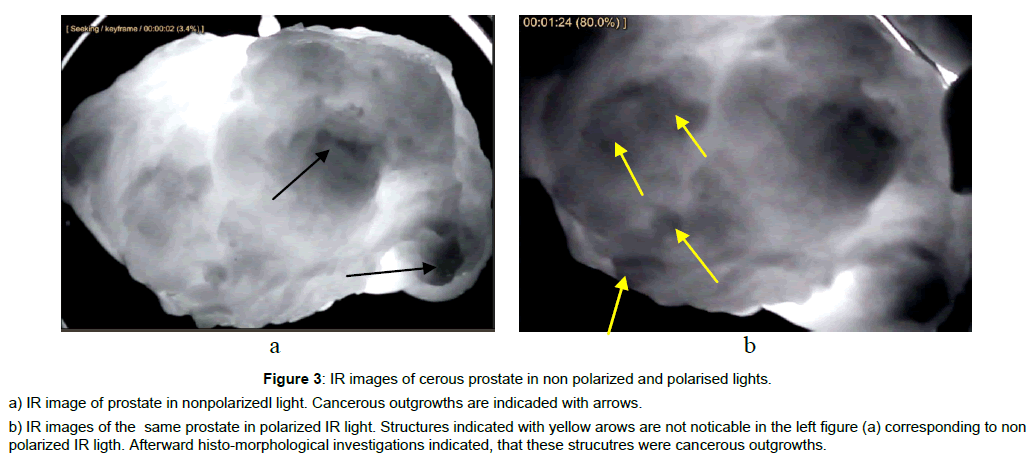 experimental-oncology-prostate-nonpolarized