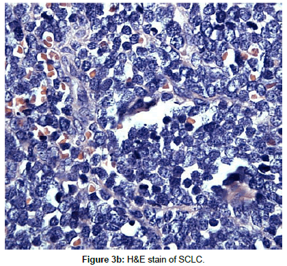 experimental-oncology-stain