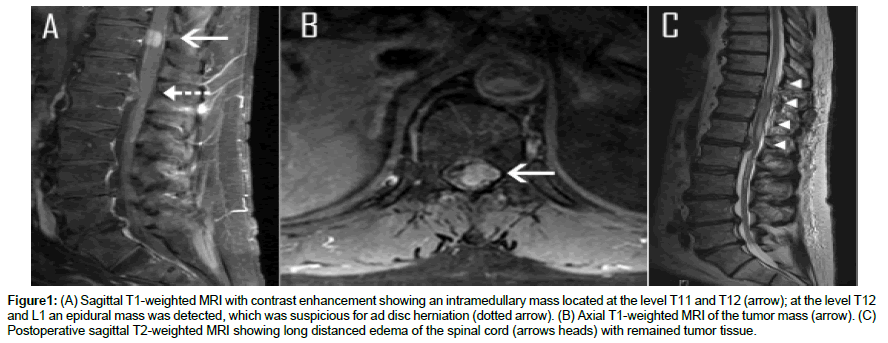 experimental-oncology-tumor-mass