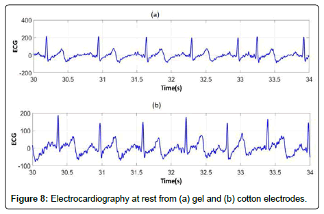 fashion-technology-textile-Electrocardiography