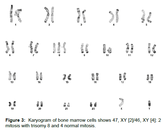 gastroenterology-mitosis-trisomy