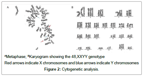 genetic-disorders-Cytogenetic-analysis