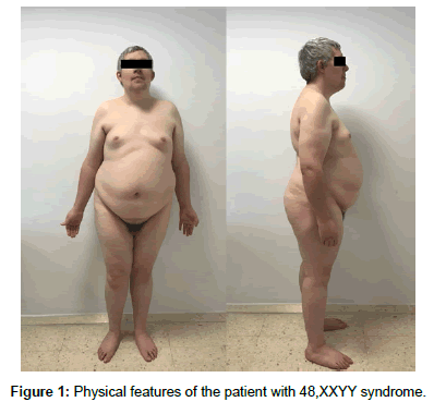 genetic-disorders-Physical-features