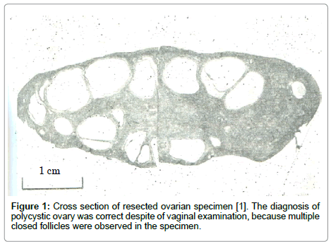 genital-system-disorders-Cross-section