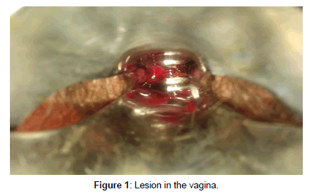genital-system-disorders-Lesion-vagina