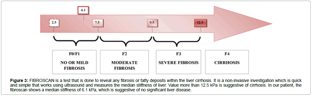 infectious-diseases-immune-ultrasound