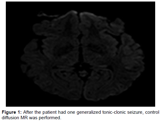 infectious-diseases-tonic-clonic-seizure