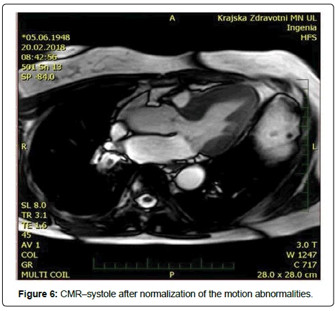 international-cardiovascular-CMR–systole