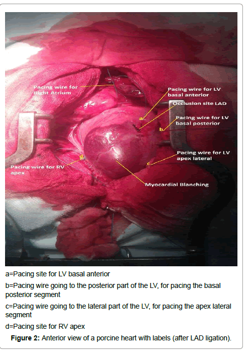 international-cardiovascular-heart-labels