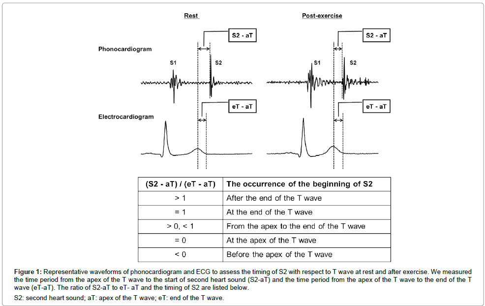 international-cardiovascular-heart-sound