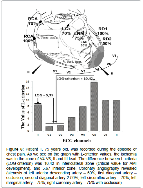 international-cardiovascular-ischemic-process