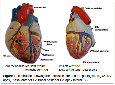 international-cardiovascular-occlusion-site