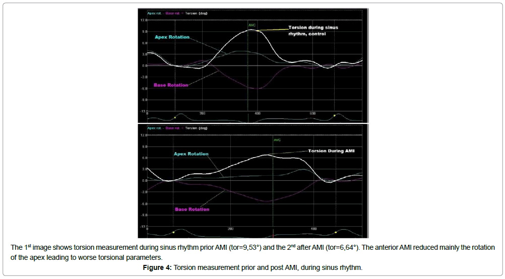 international-cardiovascular-sinus-rhythm