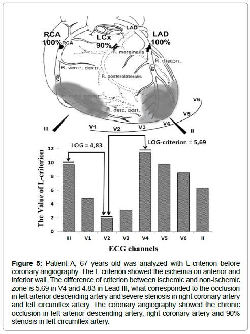 international-cardiovascular-wave-amplitudes