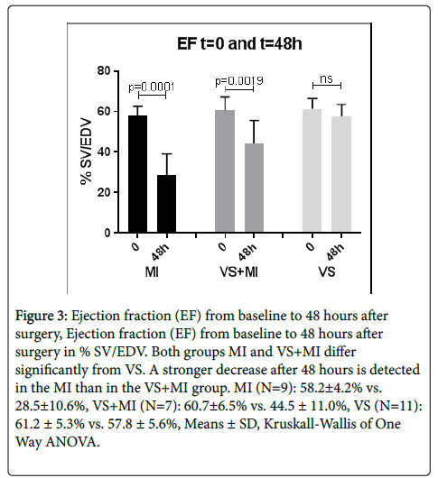 international-journal-cardiovascular-Ejection-fraction