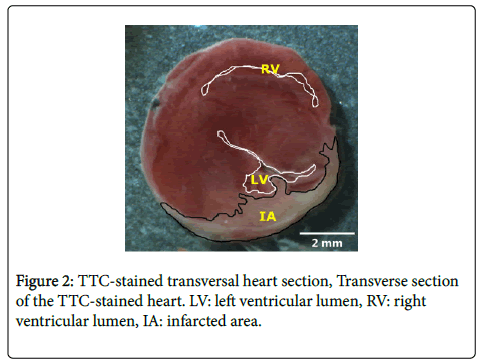 international-journal-cardiovascular-TTC-stained