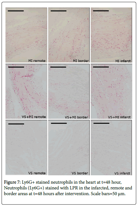 international-journal-cardiovascular-stained-neutrophils