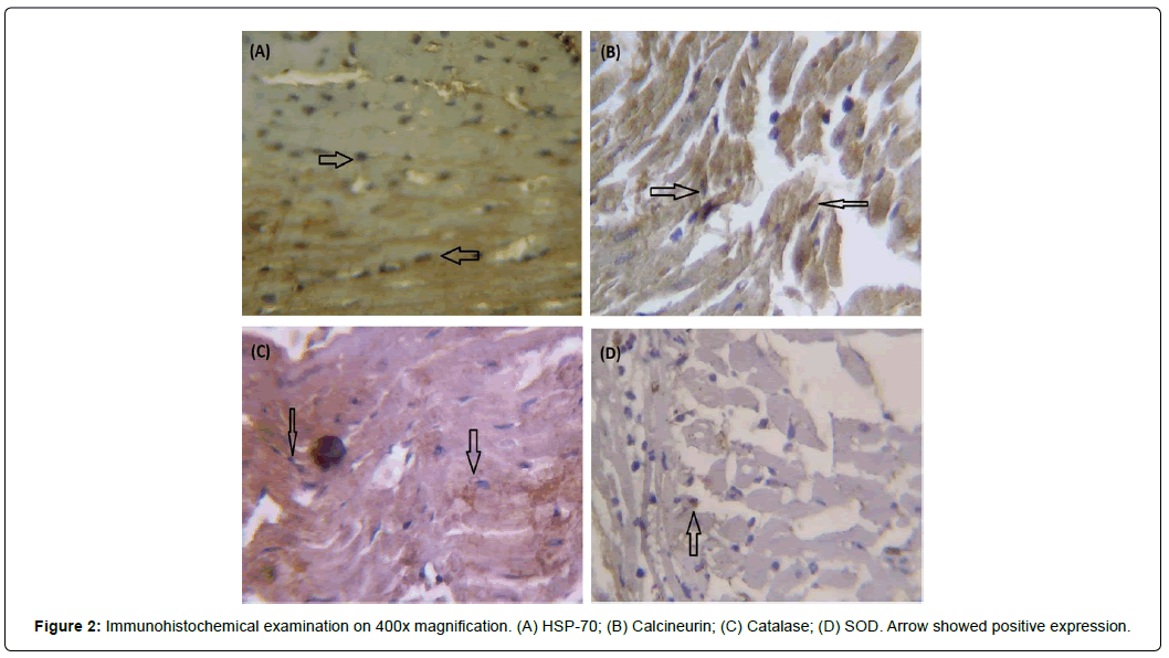 international-journal-of-cardiovascular-research-Immunohistochemical