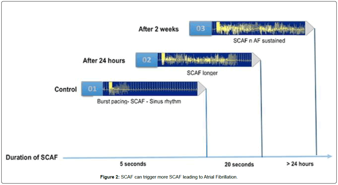 international-journal-of-cardiovascular-research-atrial-fibrillation