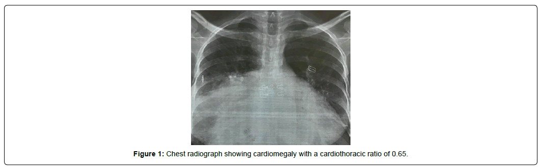 international-journal-of-cardiovascular-research-chest-radiograph