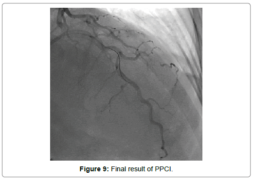 international-journal-of-cardiovascular-research-final-result