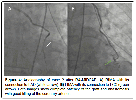 international-journal-of-cardiovascular-research-green-arrow