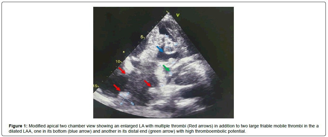 international-journal-of-cardiovascular-research-modified-apical