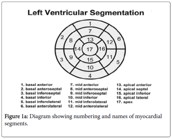 international-journal-of-cardiovascular-research-myocardial-segments
