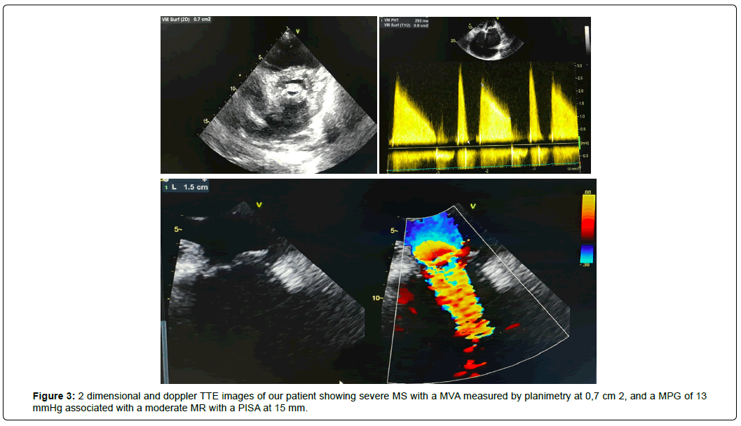 international-journal-of-cardiovascular-research-planimetry