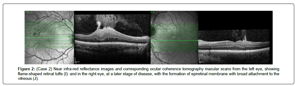 international-journal-ophthalmic-pathology-reflectance-images