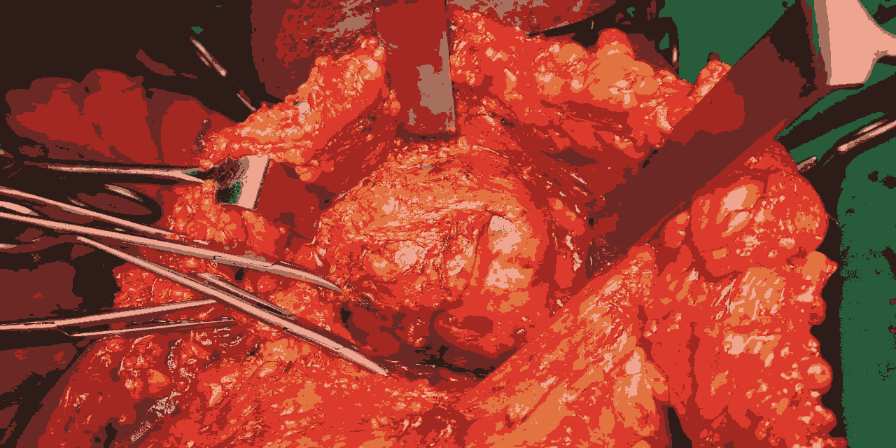 journal-clinical-axillary journal-clinical-axillary