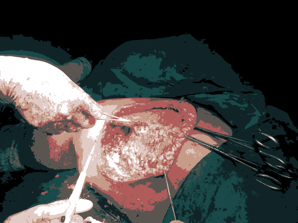 journal-clinical-dissection journal-clinical-dissection