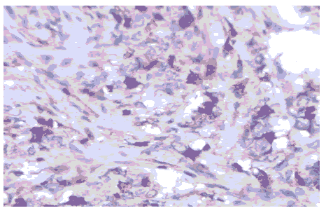 journal-clinical-ki67 journal-clinical-ki67