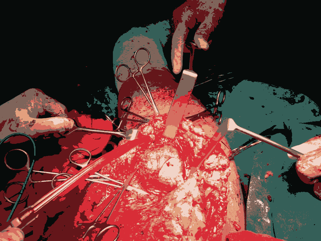 journal-clinical-lymphnode journal-clinical-lymphnode