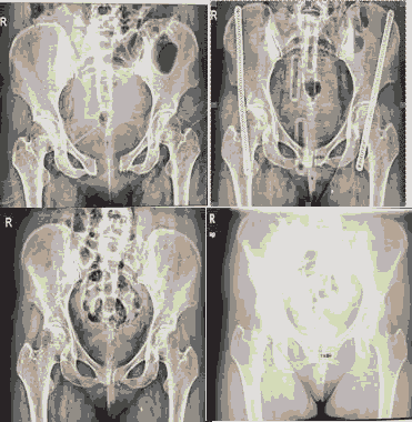 journal-women-pelvic