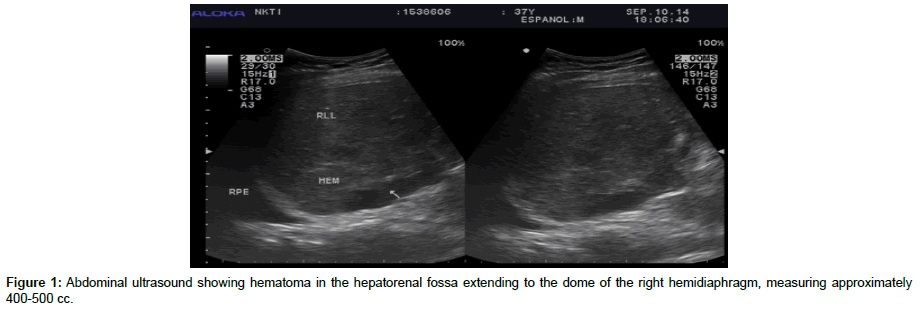 liver-disease-transplantation-Abdominal