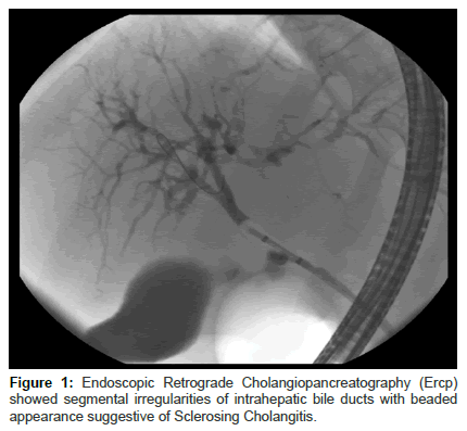 liver-disease-transplantation-Cholangiopancreatography