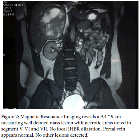 liver-disease-transplantation-Magnetic-Resonance