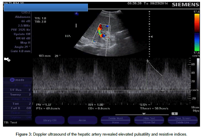 liver-disease-transplantation-hepatic-artery