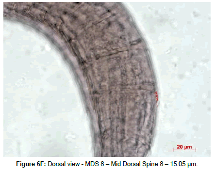 marine-biology-Dorsal-Spine