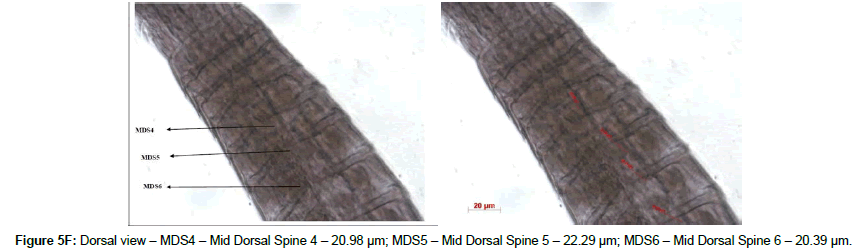marine-biology-Mid-Dorsal