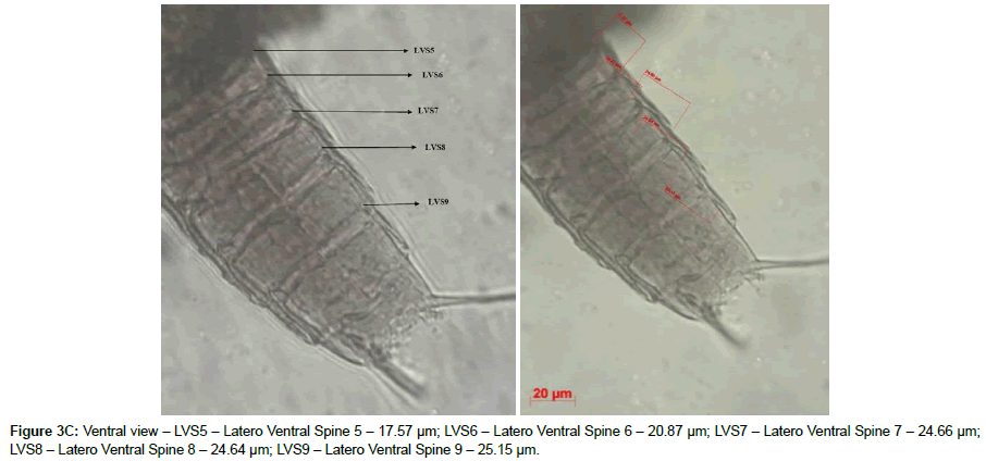 marine-biology-Ventral-Spine