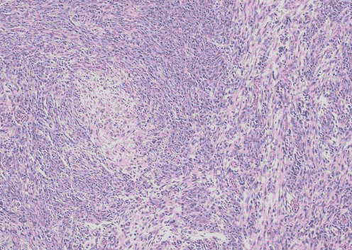 medical-microbiology-haemotoxin medical-microbiology-haemotoxin