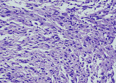 medical-microbiology-hypocellular medical-microbiology-hypocellular