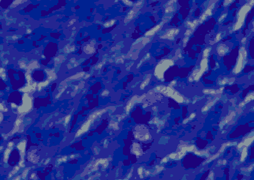 medical-microbiology-staining medical-microbiology-staining