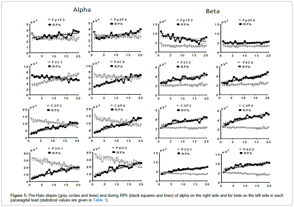 neuroscience-Pre-Habi-slopes