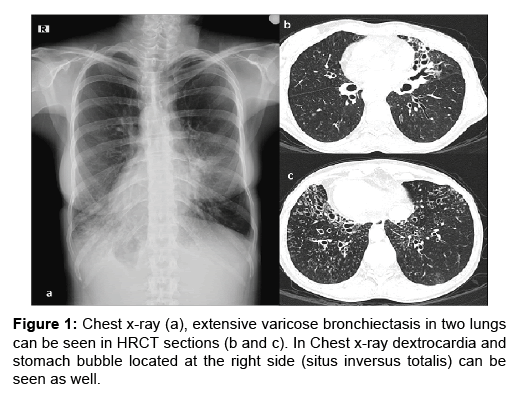 neuroscience-extensive-varicose