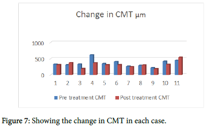 ophthalmic-pathology-CMT