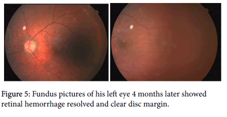 ophthalmic-pathology-Fundus-eye